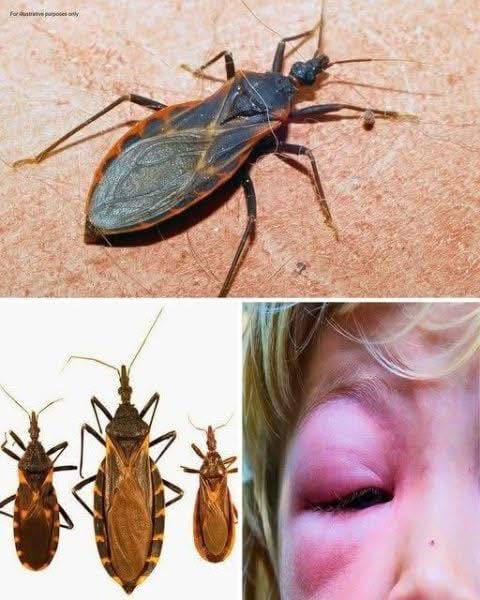 If You Ever Get Stung, Don’t Ignore It – Here’s What You Should Know