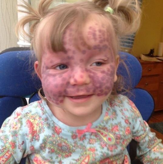 When Life Gives You Strokes: The Unstoppable Matilda Rose Callaghan