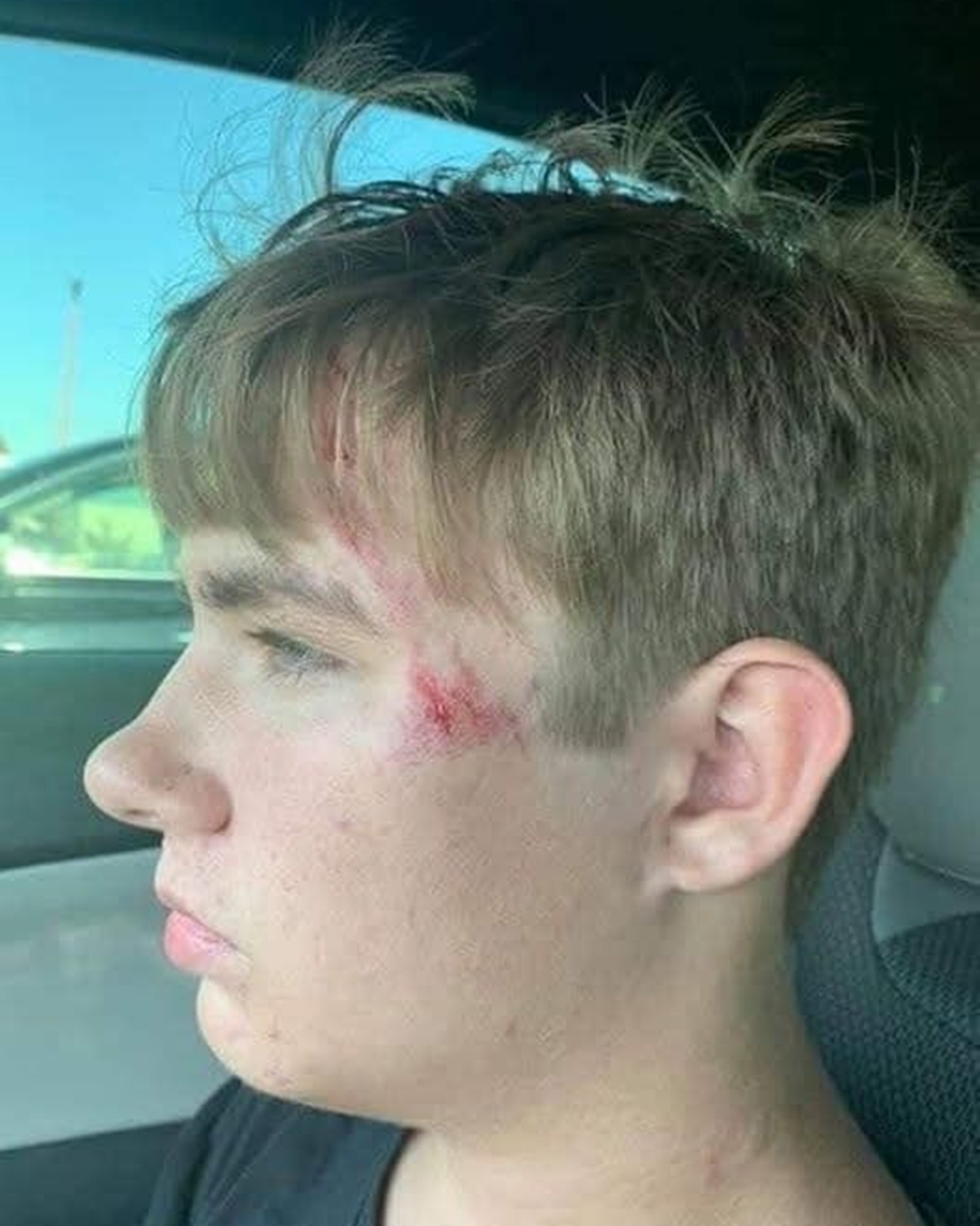 Teen Hero Saves Drowning Toddler in Scissortail Park – Courage in Action