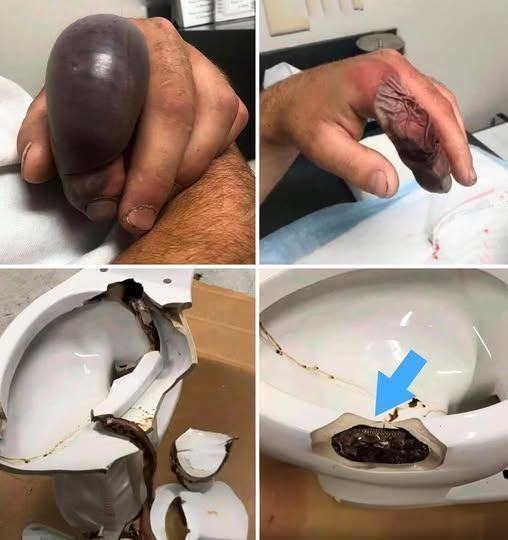 In several regions, while using their toilets, people were attacked by… see