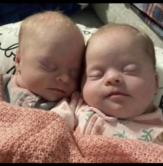 Mom of twins born with Down syndrome shuts down all negativity.