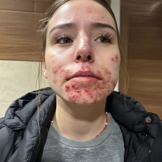 What Your Skin Could Be Telling You About Hidden Health Issues!