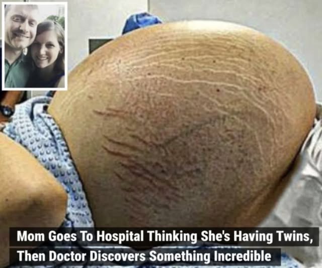Mom Goes To Hospital Thinking She’s Having Twins, Then Doctor Discovers Something Incredible