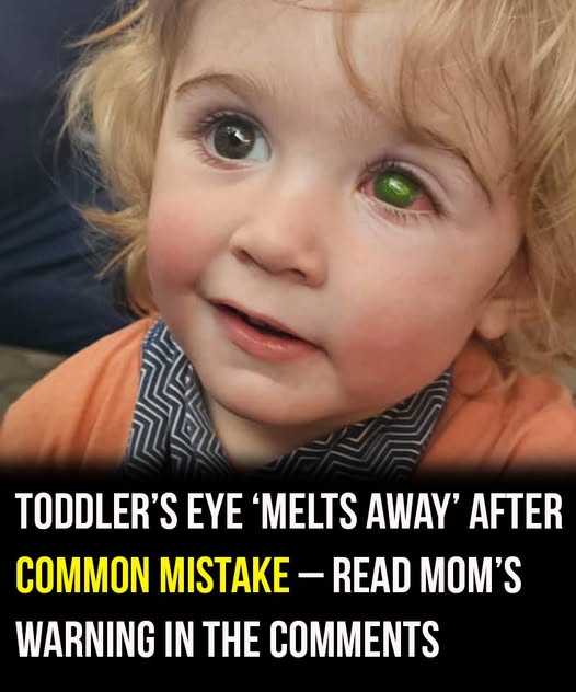 Toddler Loses Sight After Innocent Kiss Turns into a Nightmare