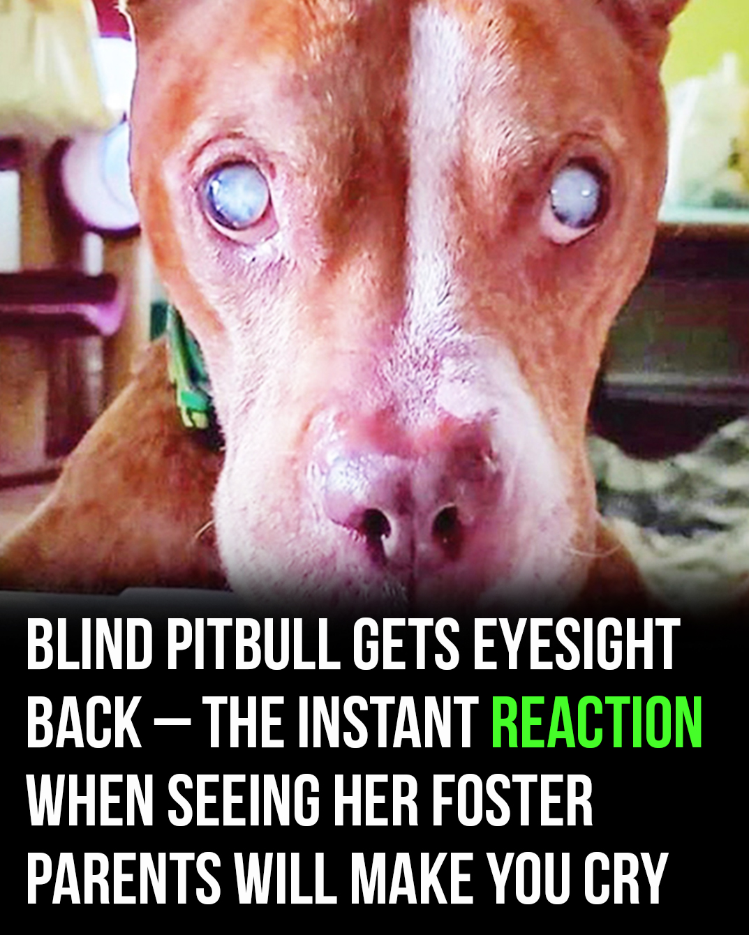 She Was Blind Her Whole Life — But When This Pit Bull Opened Her Eyes After Surgery, She Saw Her Foster Parents for the First Time
