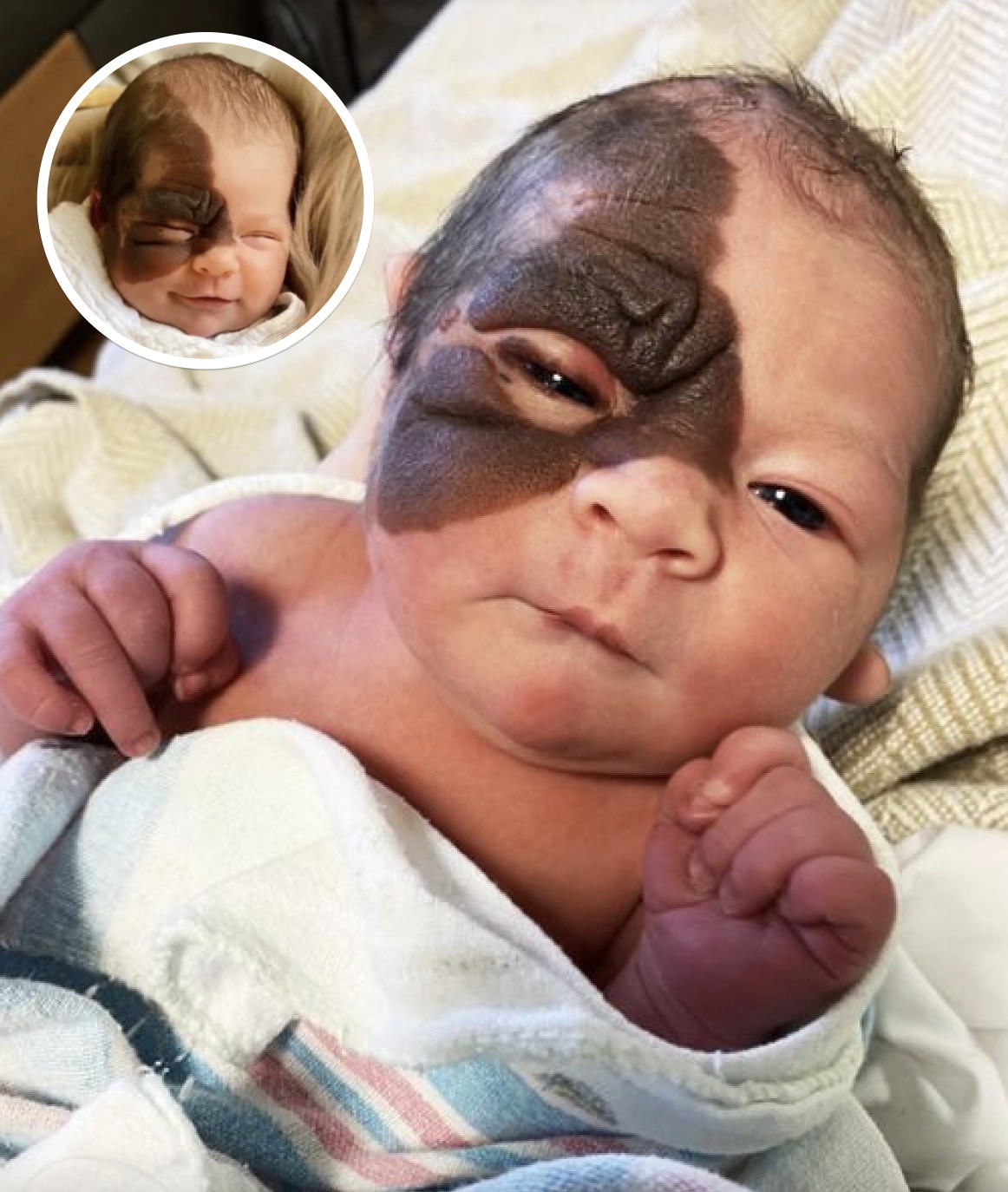 Parents Stunned When They See Newborn Daughter For The First Time, But Here Is What She Looks Like Now!