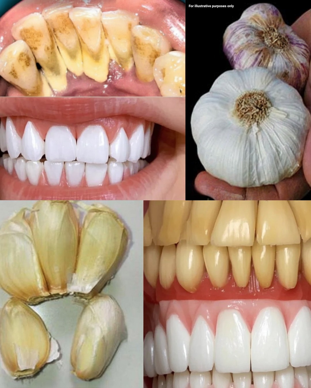 Unlock the Power of Garlic for a Healthier Smile