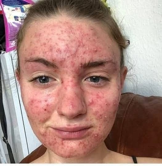 Her Body Itched for Weeks — She Thought It Was an Allergy, But the Truth Was Far Worse