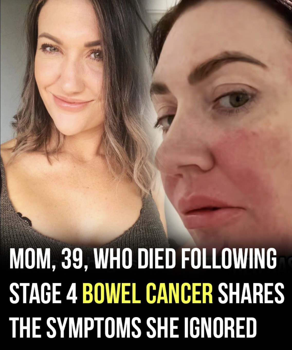 Mom, 39, Dies After Ignoring the Subtle Signs — The Symptom She Thought Was Nothing