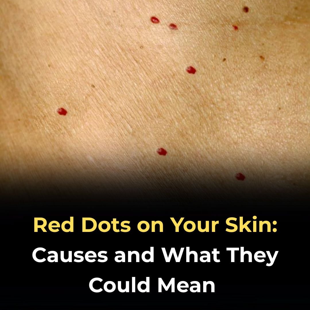 Red Dots on Your Skin: Causes, Risks, and When to Seek Help