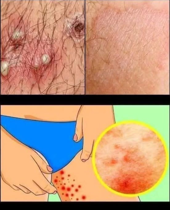 THESE ARE THE SIGNS THAT IT IS CR! SEE MORE