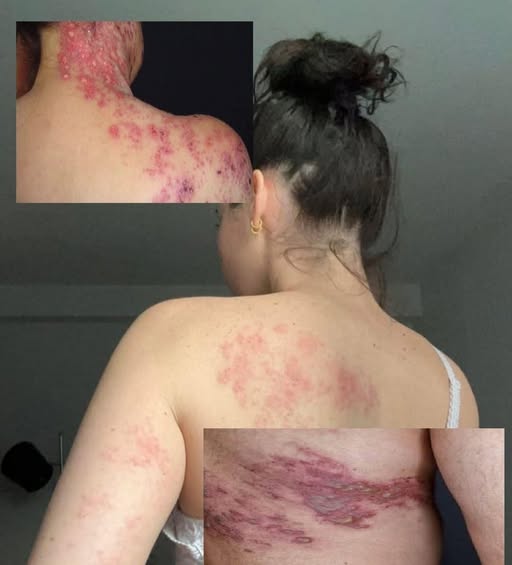 The Dangerous Consequence of Crossing Forbidden Lines