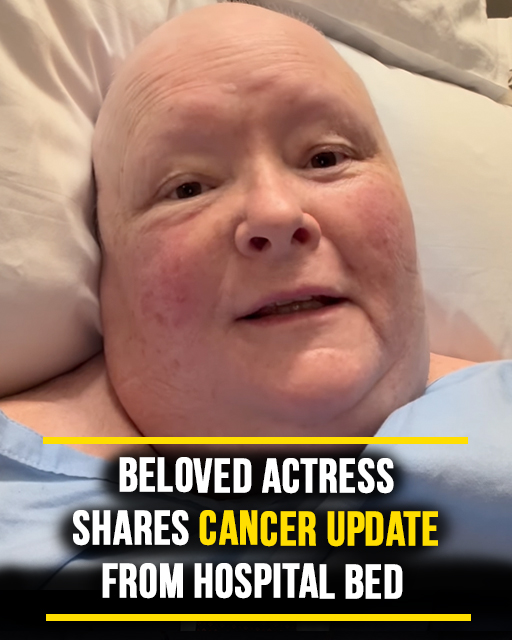 Beloved Actress Magda Szubanski Shares Emotional Update From Hospital Amid Stage 4 Cancer Battle