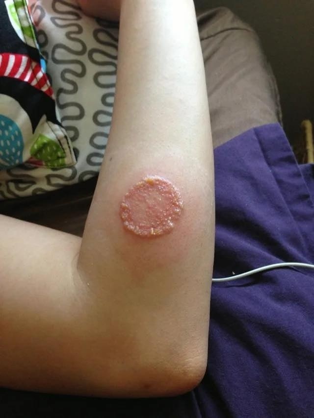 ALERT: These Are the Signs That It’s Not Just a Rash – What Happened Next Will Shock You!