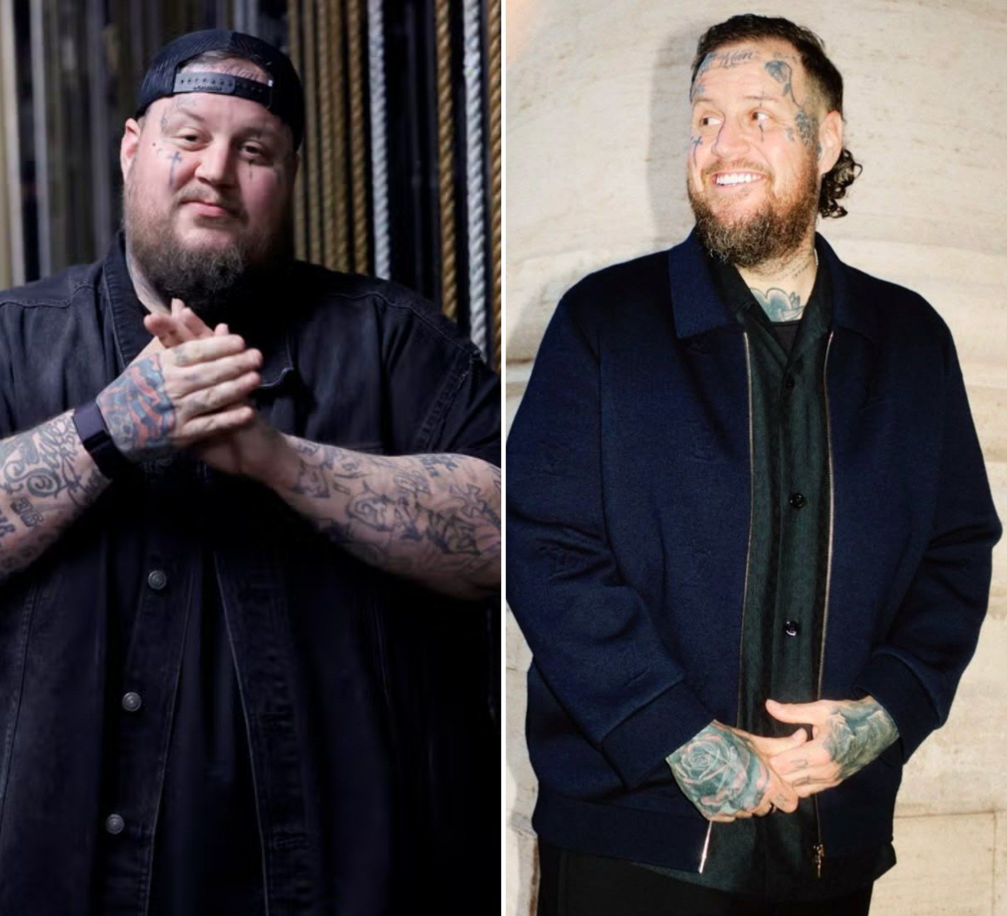 Jelly Roll’s Inspiring Transformation: From Music Stardom to Health Triumphs