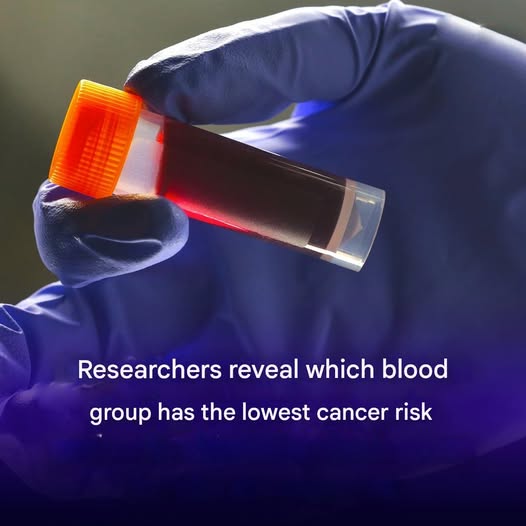 Researchers show which blood group has the lowest cancer risk