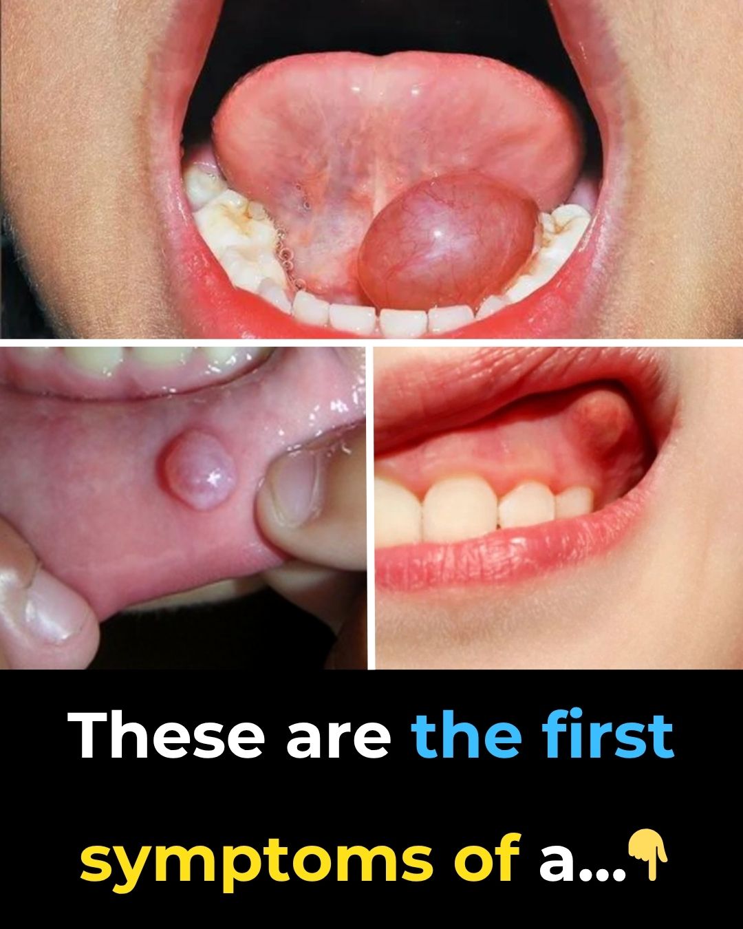 Hidden Dangers in Your Mouth: Early Signs of Oral Cancer