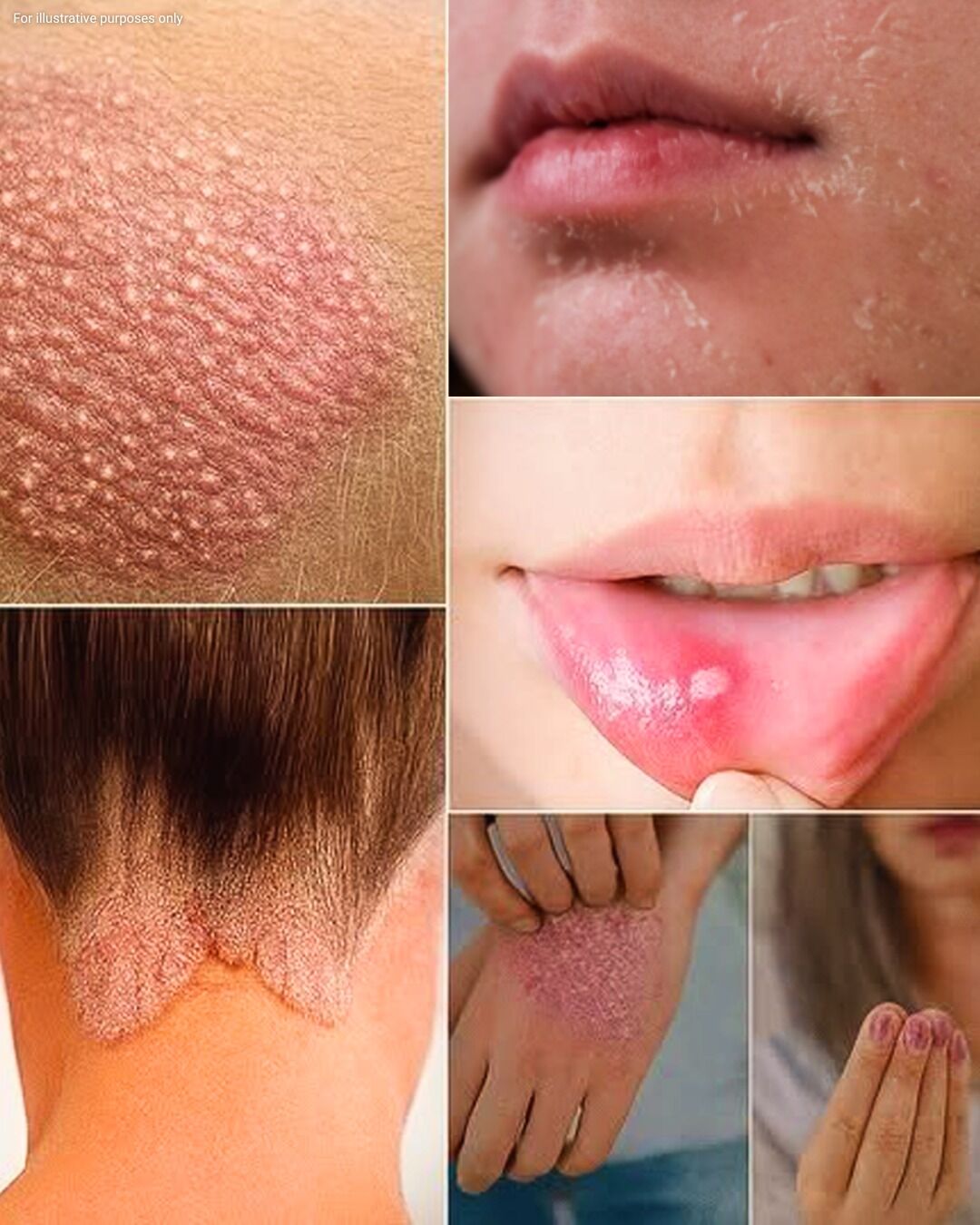 SOTD! These are the consequences of sleeping co! See more!