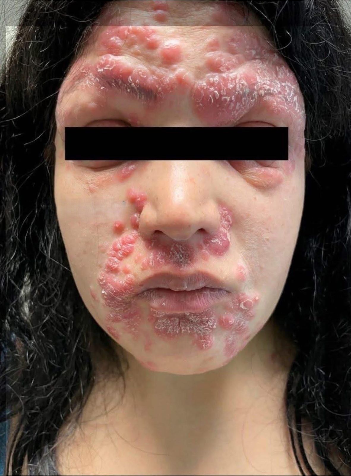 Genital Skin Changes! When to Worry and When to Relax